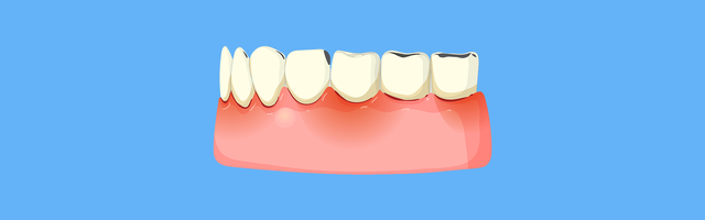 What Happens If You Don’t Remove an Infected Tooth?